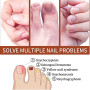 Fungus Nail Treatments Serum 7DAYS Repair Foot Onychomycosis Anti-Infection Paronychia Toe Care Nails Fungal Removal Gel