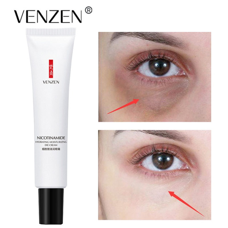 Nicotinamide Eyes Cream Whitening Dark Circles Remove Eye Bags Under