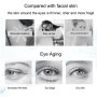 Nicotinamide Eyes Cream Whitening Dark Circles Remove Eye Bags Under Eye Hyaluronic Acid Moisturizing Serum Against Puffiness