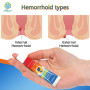 3PCS Hemorrhoids Ointment Pain Herbal Mixed Hemorrhoids Cure Internal Anal Fissure Cream Powerful External Fissure Pain Relief
