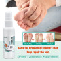 1pcs Herbal Athlete Foot Anti-fungal Spray Remove Foot Odor Beriberi Itching Foot Care Repair Toe Ulceration Medical Spray S062