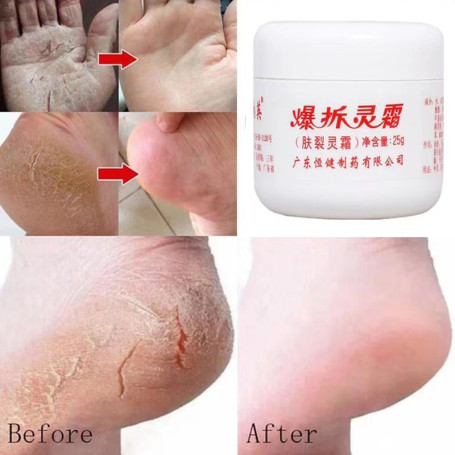 Herbal Anti Crack Foot Cream Oil Anti-Drying Crack Foot Cream Heel Cracked Repair Cream Removal Dead Skin Hand Feet Care