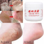 Herbal Anti Crack Foot Cream Oil Anti-Drying Crack Foot Cream Heel Cracked Repair Cream Removal Dead Skin Hand Feet Care