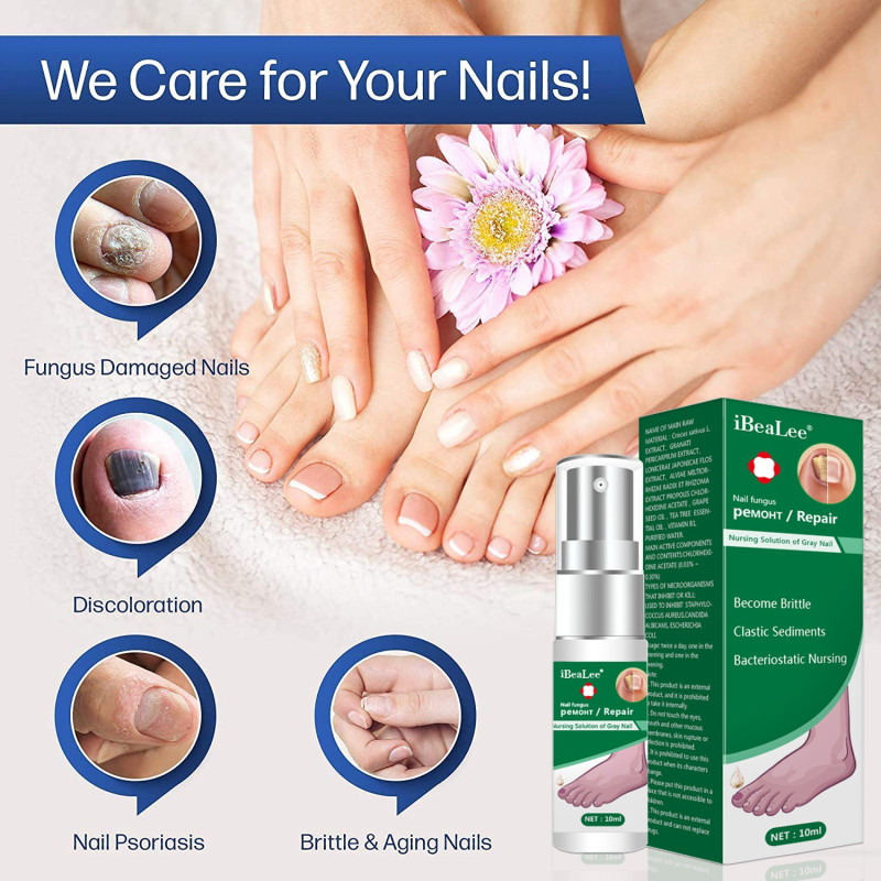 Nail Fungus Treatment Serum Onychomycosis Paronychia Anti Infection Toe ...