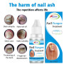 Fungus Nails Treatment for Fingernails Toenails Repair Onychomycosis Paronychia Anti Infection Toe Nail Fungal Removal Liquid