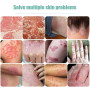 1pcs Medical Dermatitis Cream Allergic Dermatitis Eczema Cream Papules Psoriasis Cream Fungal Infection Treatment Ointment S016