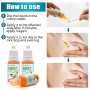 2Pcs Wart Remover Liquid Herbal Medicine Treatment Skin Tag Corns Verruca Papillomas Mole Condyloma Health Care Liquid A1509