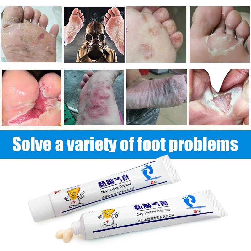 3 Types Foot Antibacterial Cream Beriberi Treatment Antifungal Cream