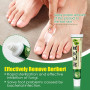 3 Types Foot Antibacterial Cream Beriberi Treatment Antifungal Cream Tinea Pedis Herbal Ointment Foot Deodorant Medical Plaster