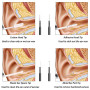 Smart Visual Medico Otoscopio Cleaner Ear Endoscope Earpick Camera Wax Remover Tool  health