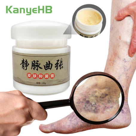 1pcs Varicose Vein Cream Treatment Ointment Promote Blood Circulation Relieve Swelling Pain Vein Health Care Cream S075