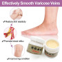 1pcs Varicose Vein Cream Treatment Ointment Promote Blood Circulation Relieve Swelling Pain Vein Health Care Cream S075