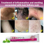 Herbal Acne Treatment Cream Folliculitis Eczema Rash Psoriasis Fungus Removal Skin Care Ointment Relieve Skin