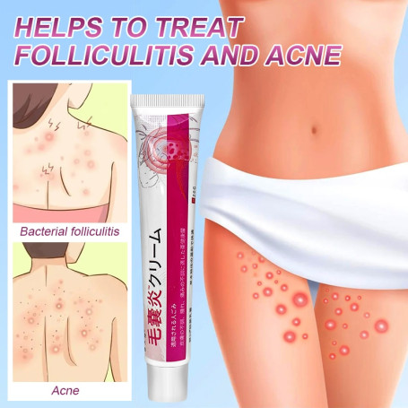 Herbal Acne Treatment Cream Folliculitis Eczema Rash Psoriasis Fungus Removal Skin Care Ointment Relieve Skin