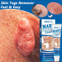 Skin Tag Remover Cream Painless Mole Skin Dark Spot Warts Remover Serum Treatment Removal Blemish Antiacne