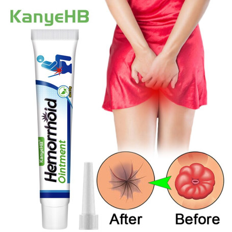 Hemorrhoid Ointment Relief Anal Swell Bleed Treat Internal External Hemorrhoids Anal Fissure Pain Relief Medical Cream G026