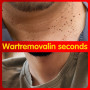 Wart Remover Cream Clean Painless Mole Skin Dark Spot Warts Remover Face Wart Tag Treatment Men Women Serum Cream