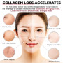 Collagen Supports Joint Health, Nails, Hair Healthy, Reduces Fine Lines and Wrinkles, Supports Digestion and Intestinal Health
