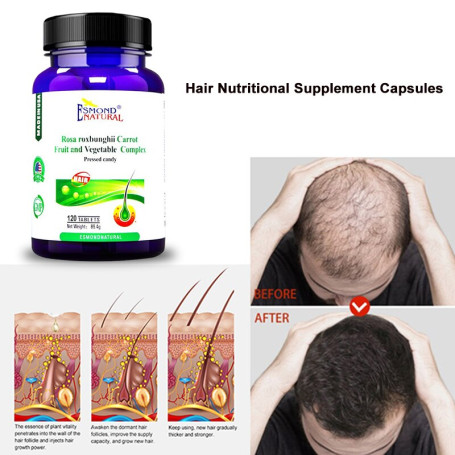 Hair Growth Supplements Prevent Hair Loss for Scalp Treatment Beauty Care Fast Hair Growth Treatment Scalp Essentials