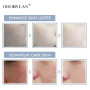 Korea 5ml Pure Micro Molecular Cross-linked Hyaluronic Acid Ampoule Mesotherapy Collagen HA Hyaluronic Acid BB Skin Whitening