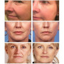 Retinol Anti Aging Remove Wrinkle Serum Lifting Brighten Face Skin Fade Eye Fine Lines Moisturizing Firming Facial Essence 30ml