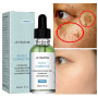 Whitening Serum Fade Dark Spot Freckle Brighten Essence Remove Pigment Melanin Correcting Beauty Face Skin Care Korea Cosmetic