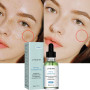 Whitening Serum Fade Dark Spot Freckle Brighten Essence Remove Pigment Melanin Correcting Beauty Face Skin Care Korea Cosmetic