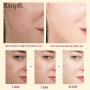 RtopR Mango Cream Beauty Health Whitening Skin Care Remove Blackheads Moisturize Skin Oil Control Shrink Pores Face Care