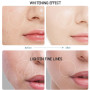 BEAUTYCOME 50ml Collogen Face Serum Nicotinamide Whitening Firming Moisturizing Anti Wrinkle Shrinking Pores Facial Skin Care
