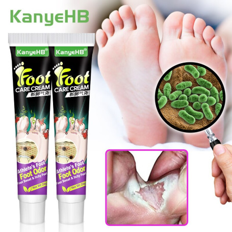 2pcs Inhibit Fungi Tinea Pedis Cream Medical Beriberi Ointment Foot Psoriasis Eczema Remove Foot Odor Feet Skin Erosion A1283