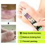 2pcs Inhibit Fungi Tinea Pedis Cream Medical Beriberi Ointment Foot Psoriasis Eczema Remove Foot Odor Feet Skin Erosion A1283