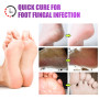 2pcs Inhibit Fungi Tinea Pedis Cream Medical Beriberi Ointment Foot Psoriasis Eczema Remove Foot Odor Feet Skin Erosion A1283