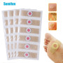 12/24/36Pcs Foot Corn Removal Patch Calluses Plantar Warts Pain Relief Curative Plaster Thorn Detox Adhesive Sticker Health Care
