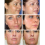 LAIKOU Vitamin C Whitening Facial Serum Remove Dark Circles Fade Freckles Spots Melanin Moisturizing Brightening Face Essence