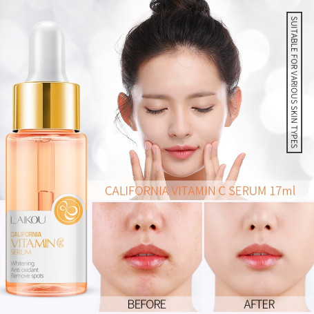 LAIKOU Vitamin C Whitening Facial Serum Remove Dark Circles Fade Freckles Spots Melanin Moisturizing Brightening Face Essence