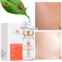 Snail Essence Hyaluronic Acid Liquid Face Whitening Spot Essence Shrink Pores Ampoule Anti-acne Regenerative Cream Skin Care