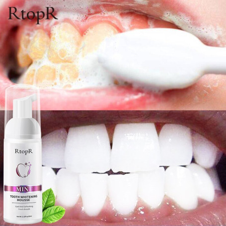 Teeth Cleansing Whitening Mousse Tooth Removes Stains Essence Oral Hygiene Dental Mousse Cleaning Tools Toothpaste For Adults