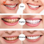 New Teeth Whitening Pen Tooth Gel Whitener Bleach Remove Stains Instant Smile Teeth Whitening Kit Cleaning Serum Beauty Health